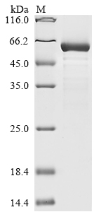 Human 14-3-3 protein sigma Protein
