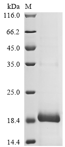 Puccinia triticina Uncharacterized Protein