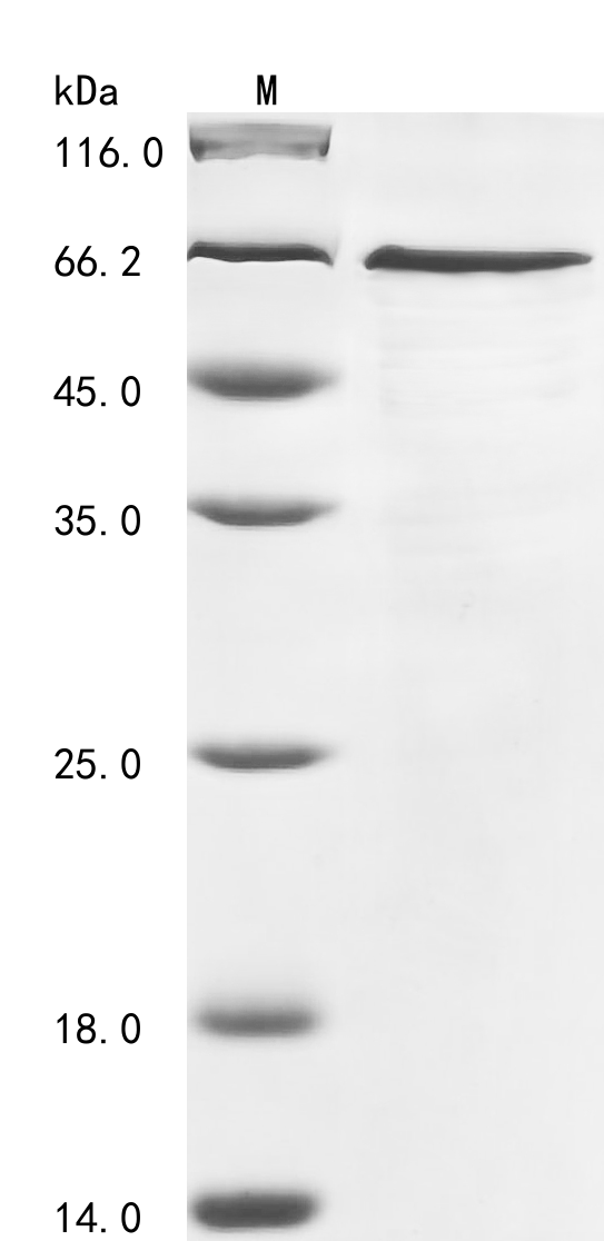 Human G3BP1 Protein