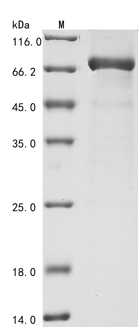 Human NR4A1 Protein