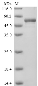 Human PIP4K2B Protein
