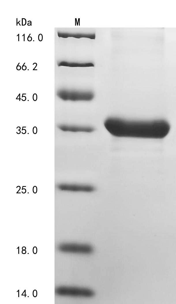 Human STK38L Protein
