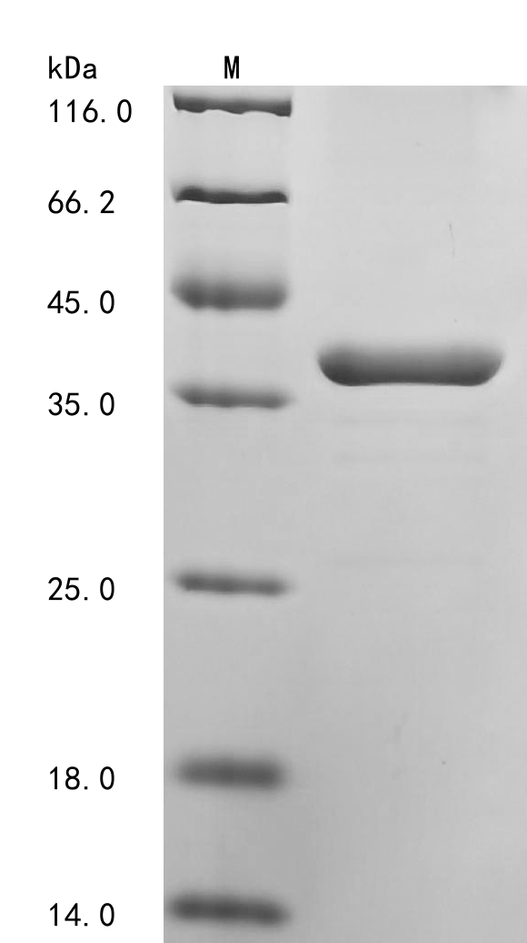 Rat Tfrc Protein