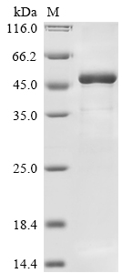 Rabies virus Matrix Protein
