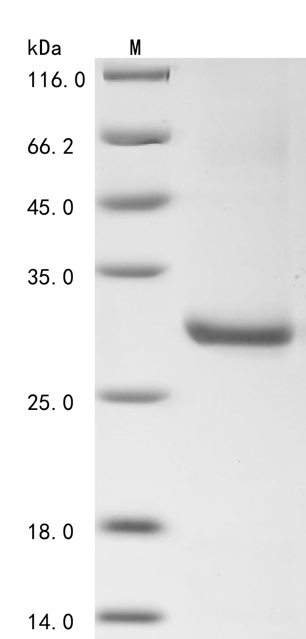Human NOS2 Protein