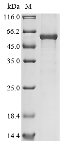 Human DDAH2 Protein