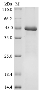 Human MCM9 Protein