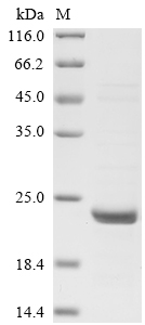 Human GBP2 Protein