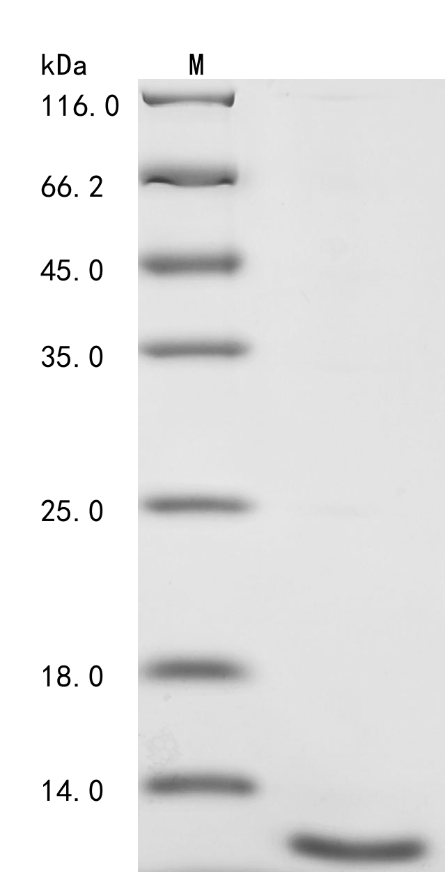 Human PPA1 Protein