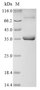 Human COG5 Protein