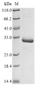 Human KIR2DL5B Protein