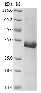 Human KIR2DL5A Protein