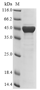 Human adenovirus C serotype 5 Fiber Protein