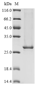 Human BTK Protein