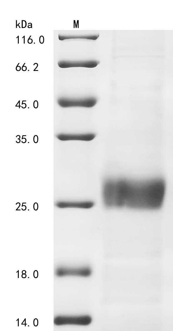 Avian infectious bronchitis virus Spike glycoprotein Protein
