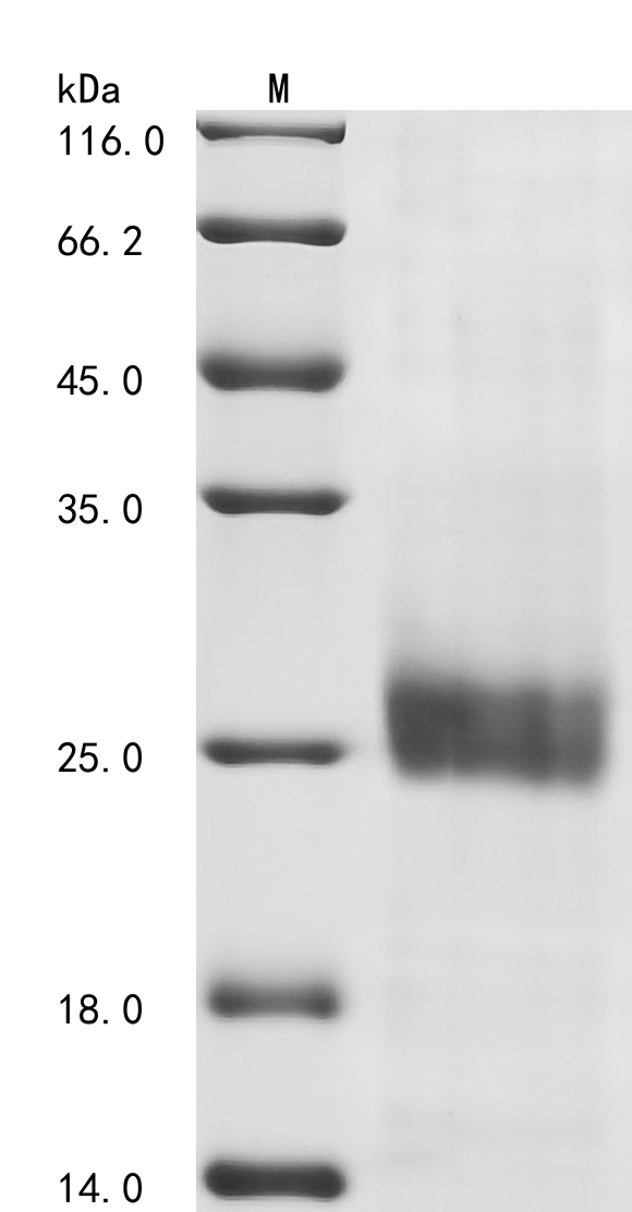 Avian infectious bronchitis virus Spike glycoprotein Protein