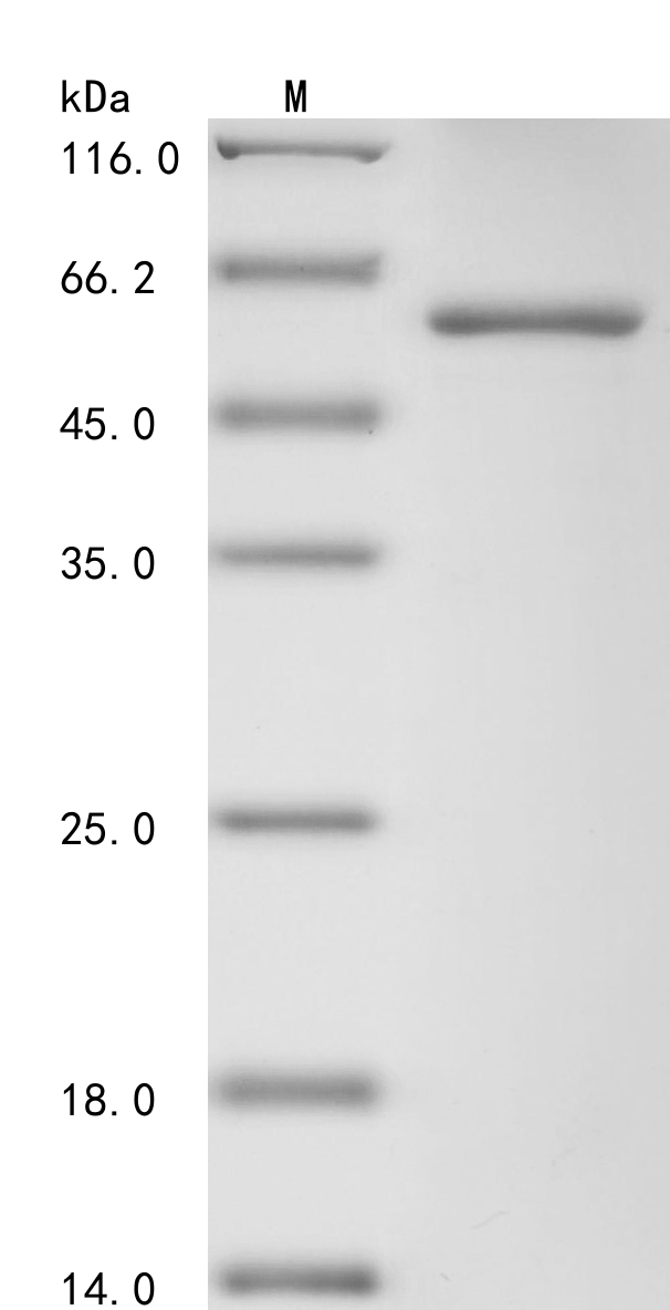 Avian infectious bronchitis virus Nucleoprotein Protein