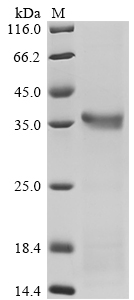 Mouse Mbl2 Protein