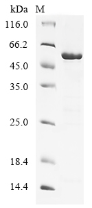 Human STK38L Protein