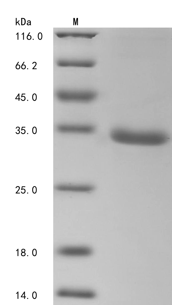 Human TRIM72 Protein
