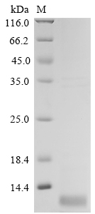 Avian infectious bronchitis virus Non-structural protein 3b Protein