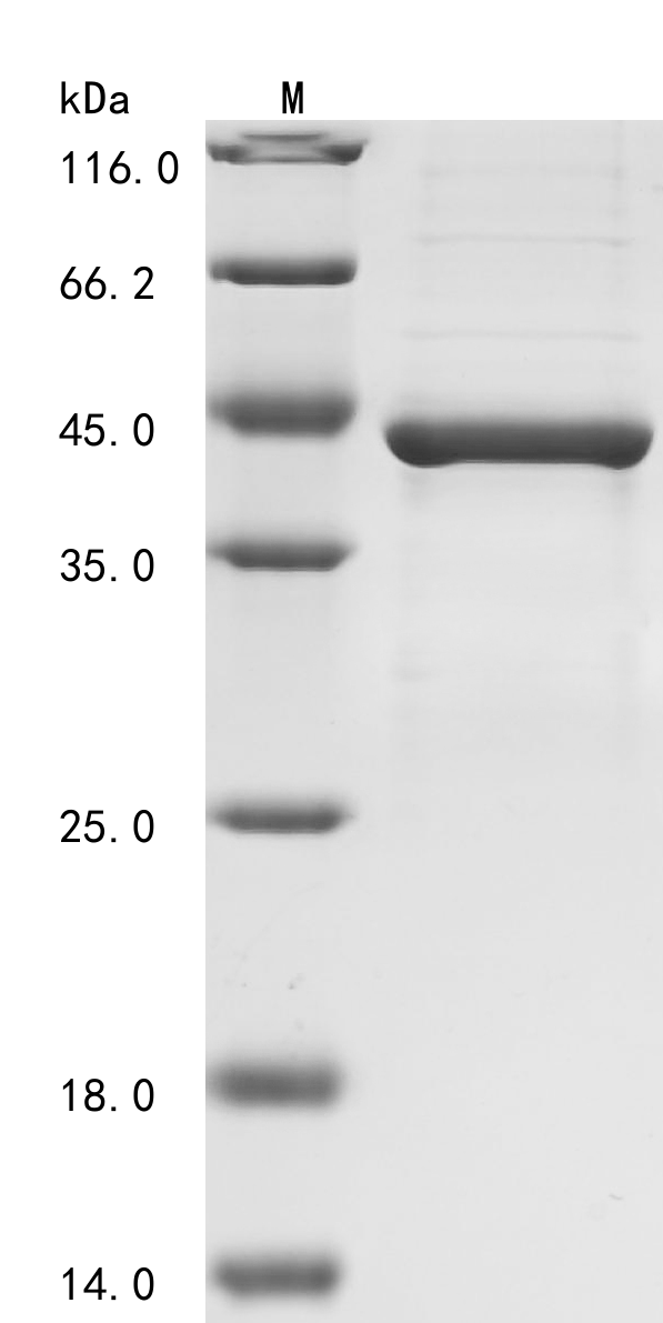Human NOS2 Protein