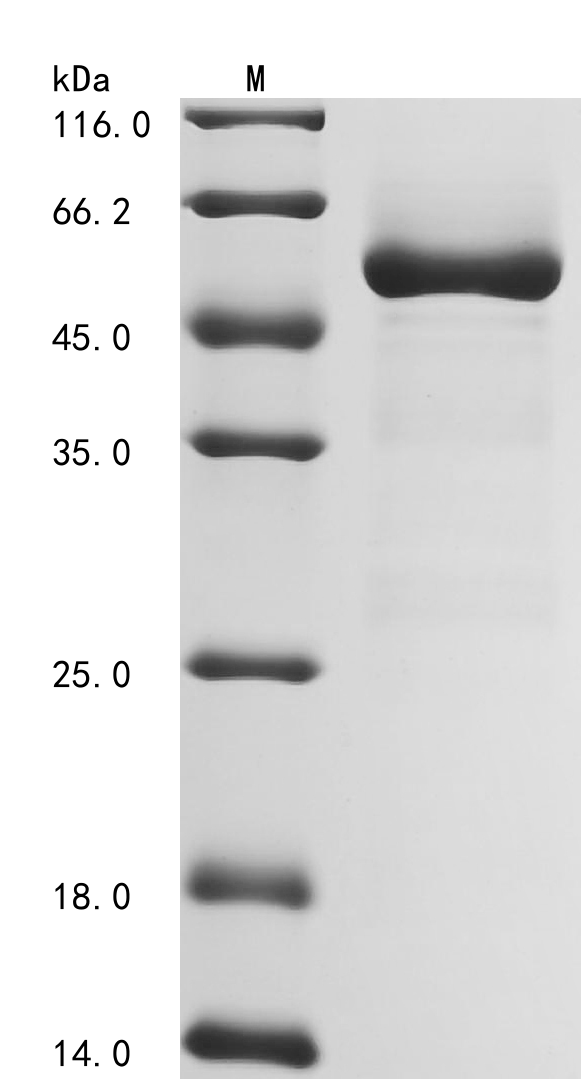 Human PPA1 Protein