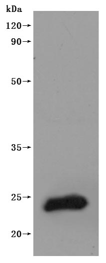 Human CLDN9-VLPs Protein