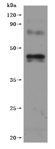 Human CNR1-VLPs Protein