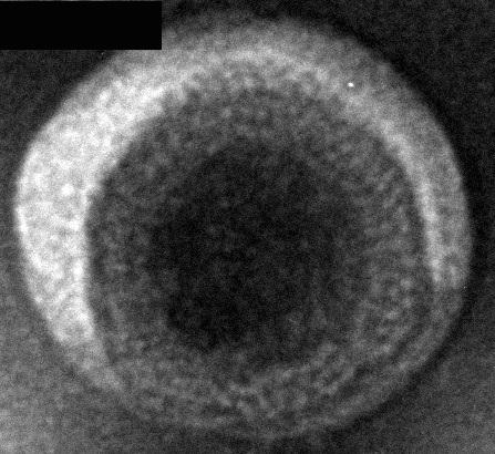 Human CCR4-VLPs Protein