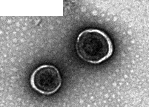 Human C5AR1-VLPs Protein