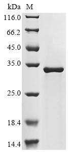 Human NPC1 Protein