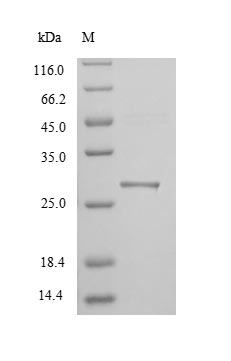 Mouse Havcr1 Protein