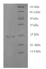 Human HLA-DQA1 Protein