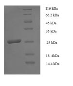 Human HLA-DPB1 Protein