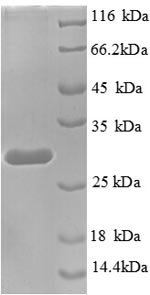 Human TTF1 Protein