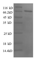 Human PAX2 Protein