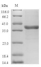 Human VEGFC Protein