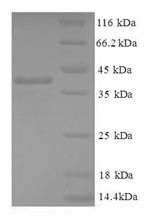 Human GABARAPL2 Protein