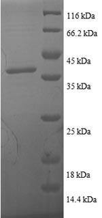 Human TXN Protein