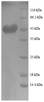 Human RHOA Protein