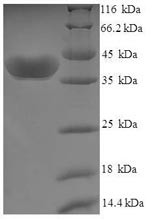 Human UCK1 Protein