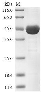 Human IDH1 Protein