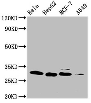 GSTM3 Antibody