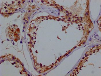GSTM3 Antibody