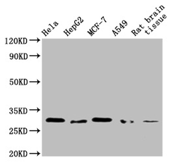 GSTM3 Antibody