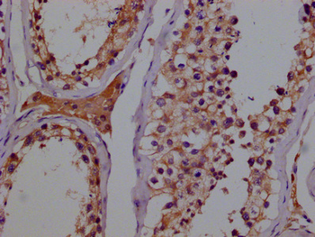 GSTM3 Antibody