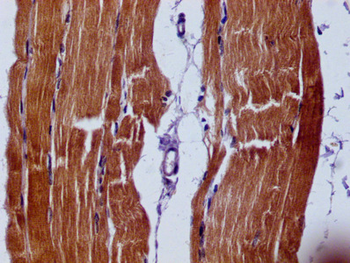 SLN Antibody