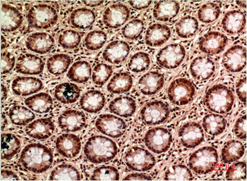 TUBG1 Antibody
