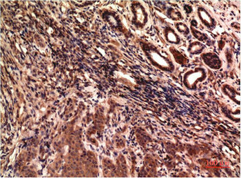 TUBG1 Antibody